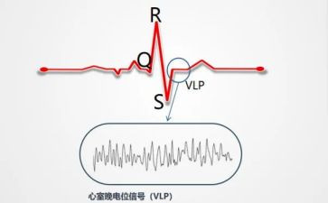 2024年心电图室工作总结5篇
